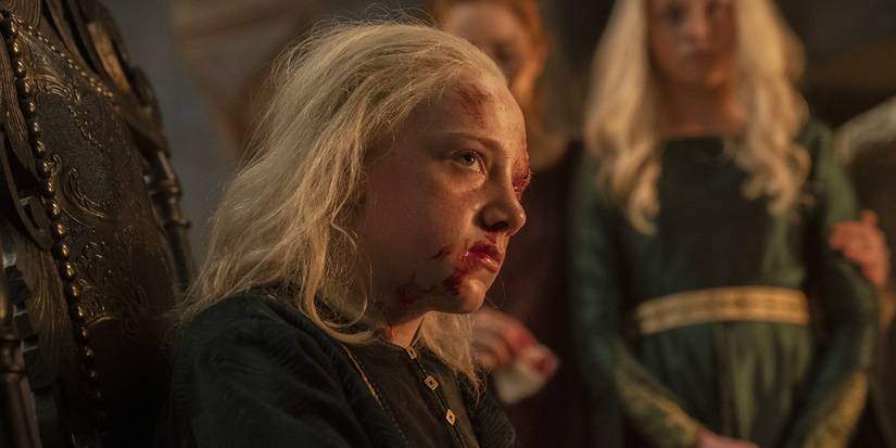 Leo Ashton as young Aemond Targaryen in House of the Dragon with one bloody eye 