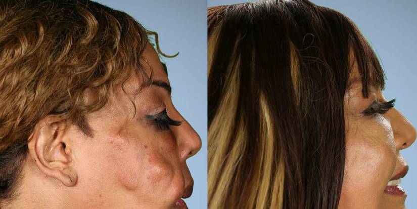 Botched Attempt ‘Botched’ Exposes How Plastic Surgery Mishaps Feed Our Souls