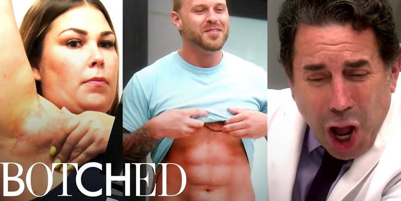 ‘Botched’ Exposes How Plastic Surgery Mishaps Feed Our Souls