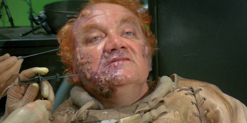Baron Harkonnen getting injections in his face in David Lynch's Dune (1984)