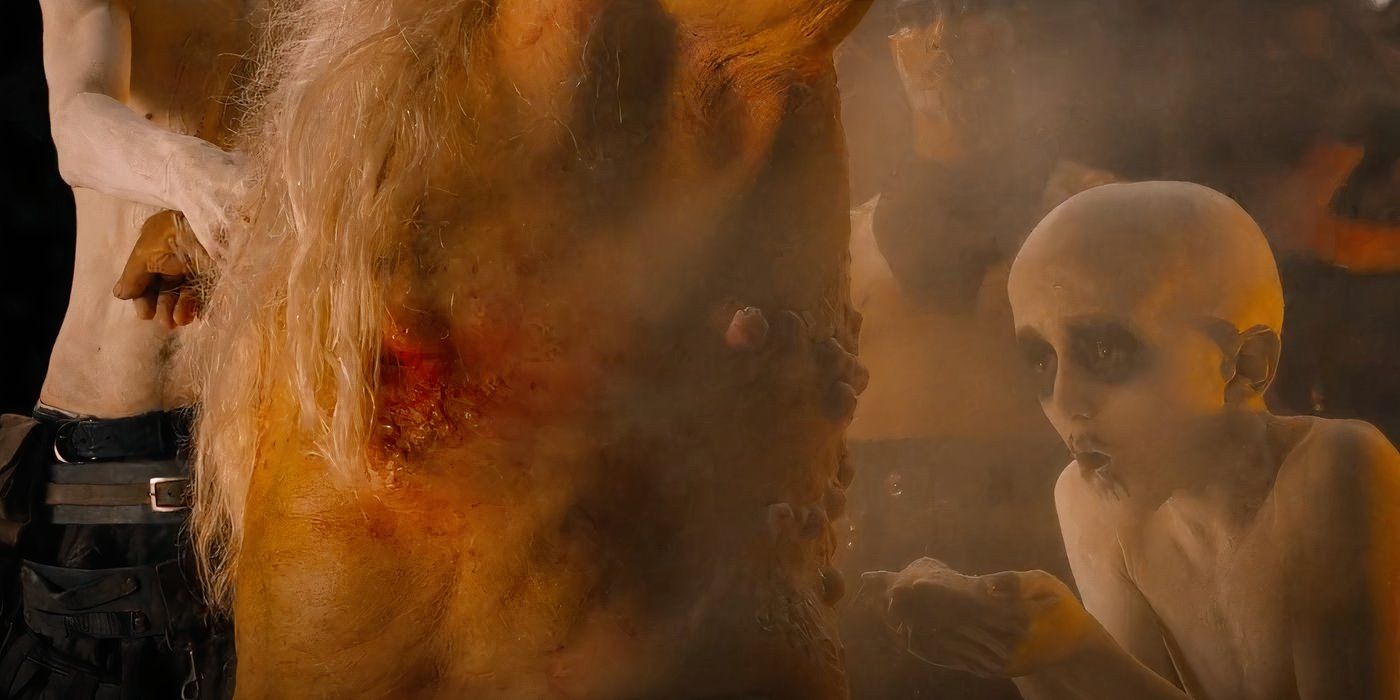 What Sickness Does Immortan Joe Have In the Mad Max Movies?