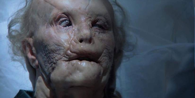 The horribly disfigured face of Mason Verger (Gary Oldman) in Hannibal (2001).