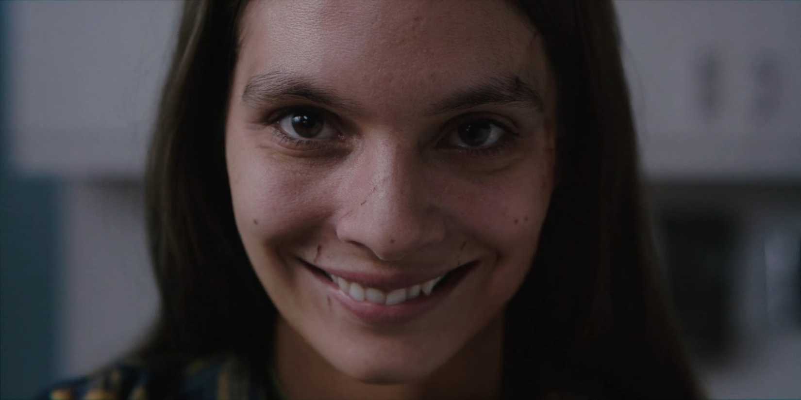 a patient smiles evilly directly into the camera in Smile