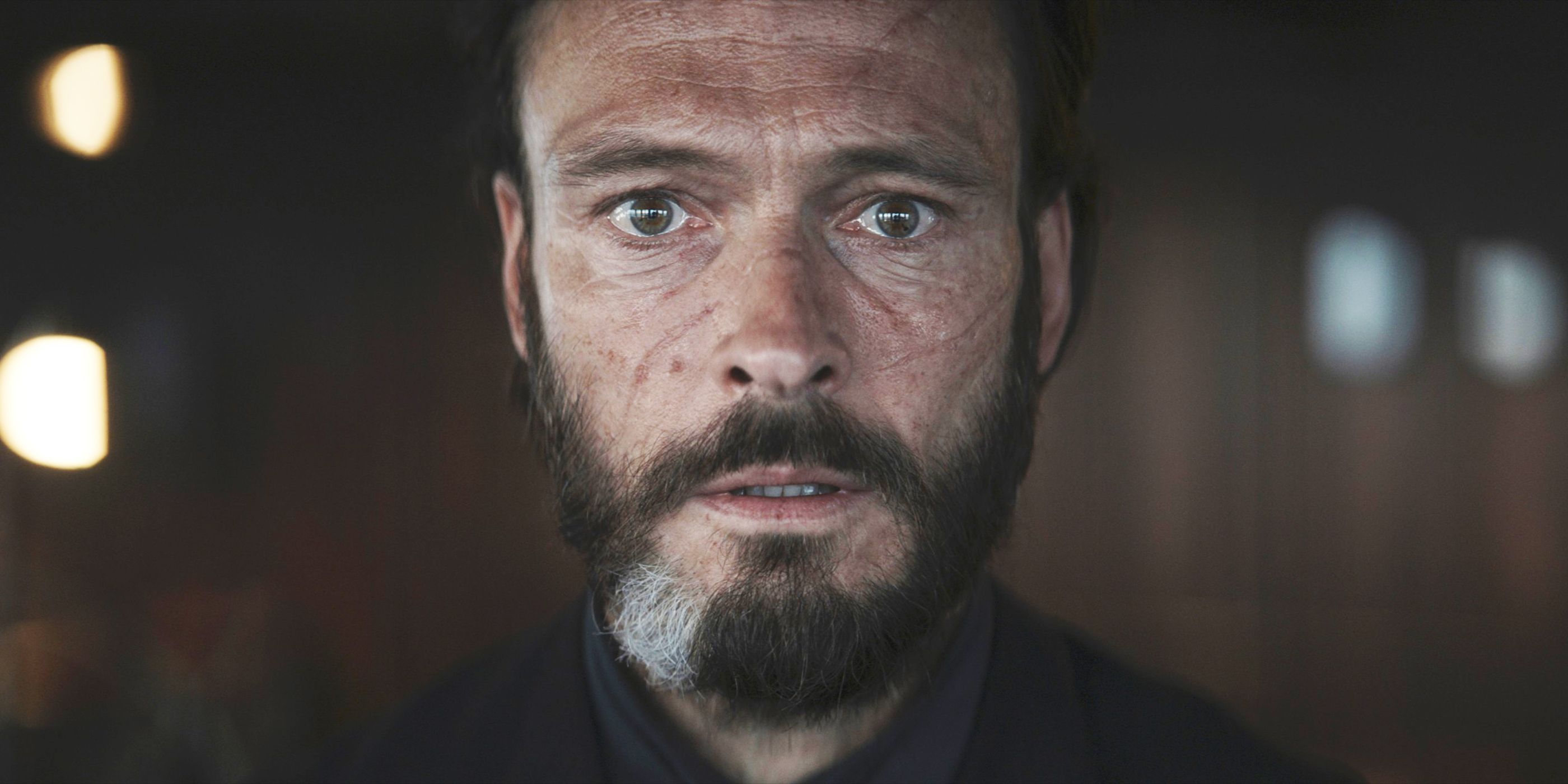 Man with a beard looking surprised