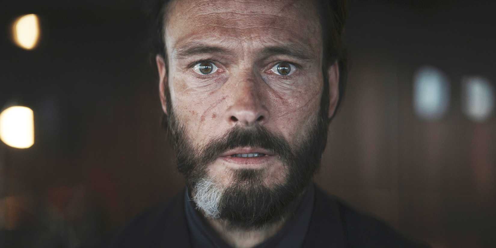 Man with a beard looking surprised