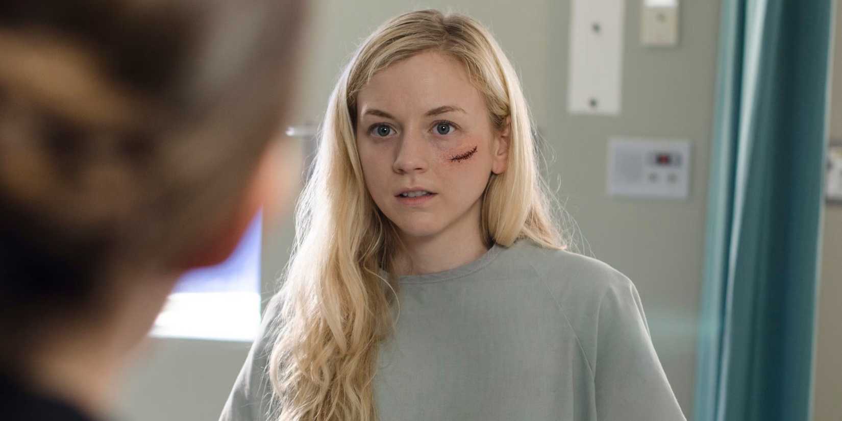 Emily Kinney as Beth with a cut on her upper left cheek in The Walking Dead