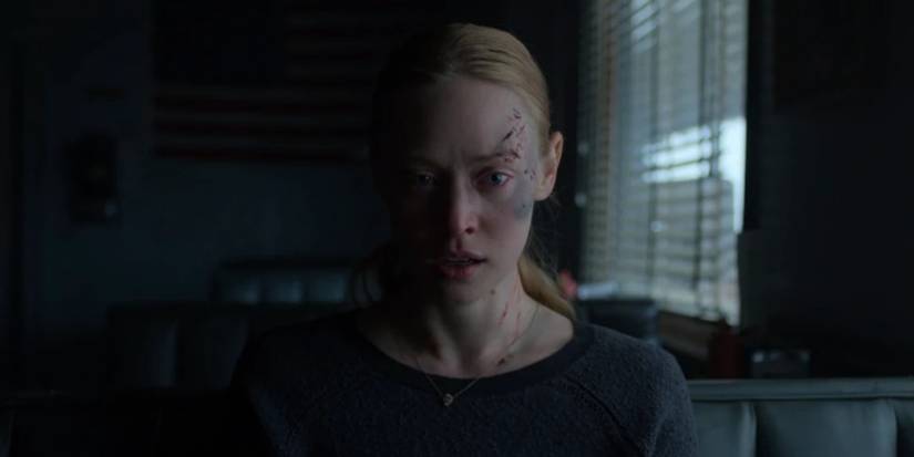 Karen Page (Deborah Ann Woll) with bruises and cuts on her face in Daredevil Season 3.